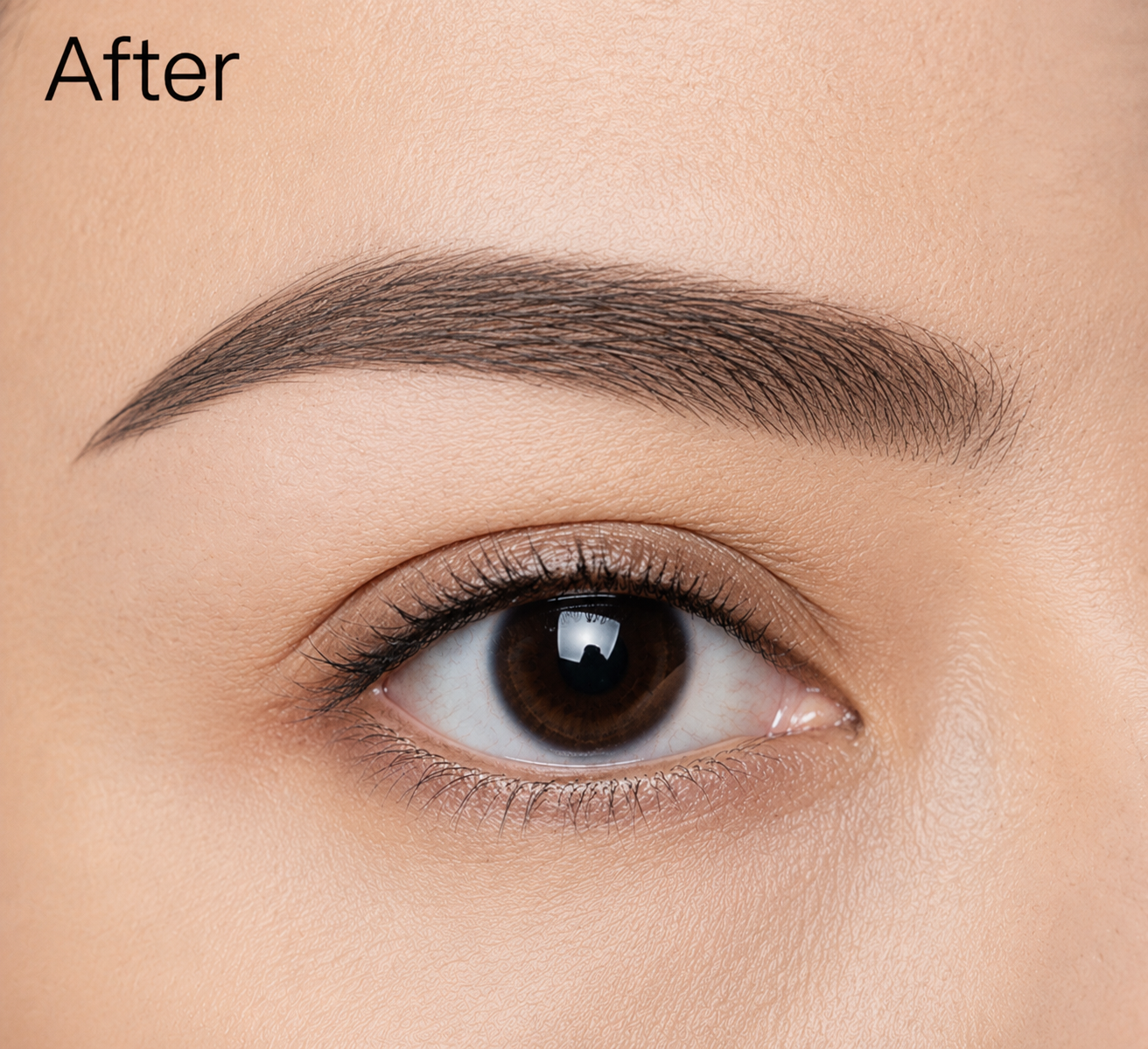 After